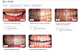 DENTAL.MED – сайт Стоматологии с модулем записи - Landing page